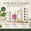 🌿 Acne Rescue Bundle – Clear Skin Routine